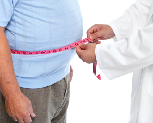 Doctor measuring obese man waist body fat